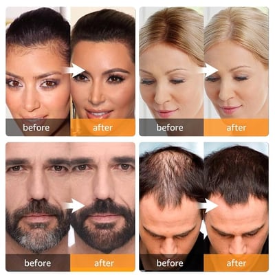 🔥 2025 Jahr Heißer Verkauf 50% OFF 🔥 Hairline Powder und Root Cover Up für mühelose Schönheit