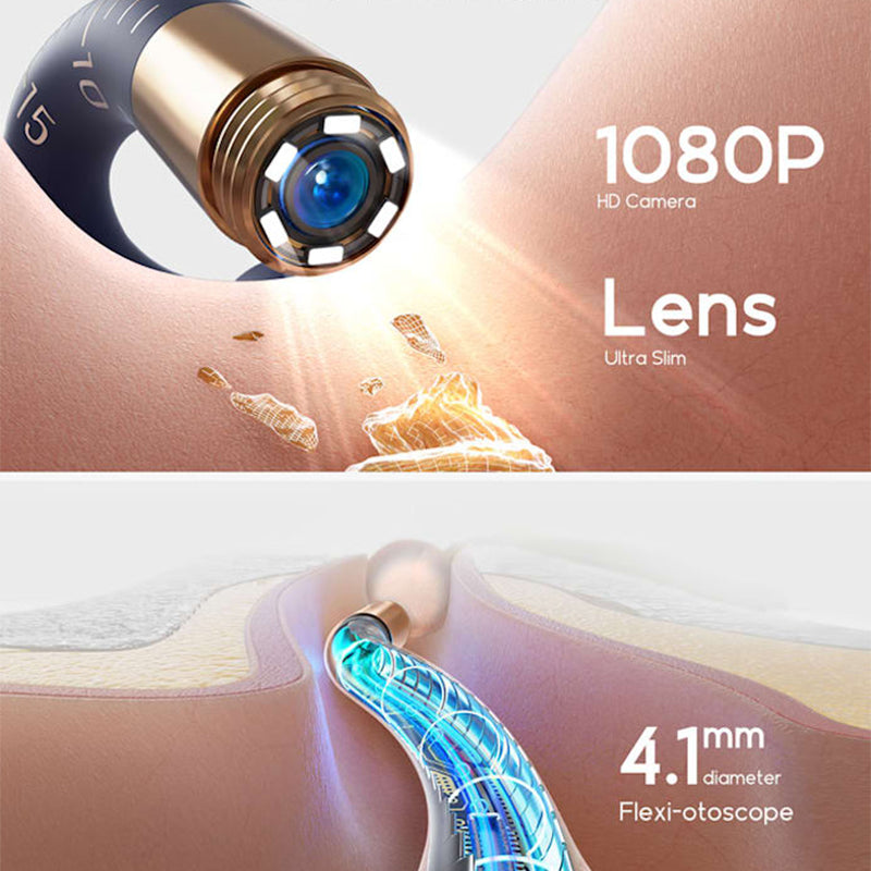 ⏳Zeitlich begrenztes Angebot⌛ Visuell gebogenes Ohrschmalz-Entfernungsset