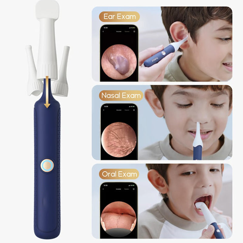 ⏳Zeitlich begrenztes Angebot⌛ Visuell gebogenes Ohrschmalz-Entfernungsset