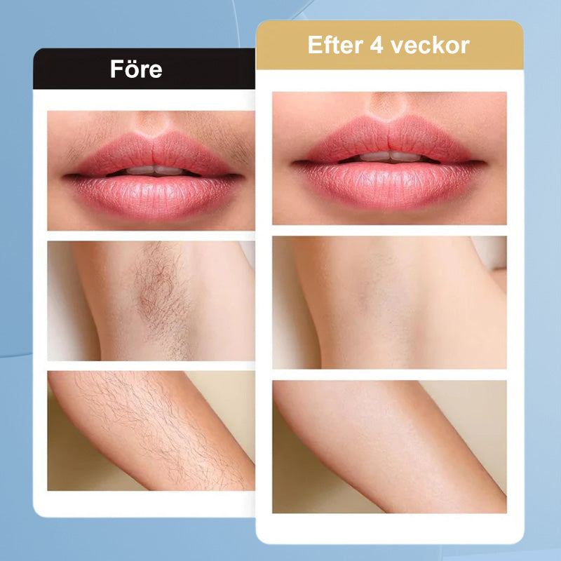🔥9 Ebenen der Haarentfernung 🧊laser IPL schmerzfrei. (Erstattungsfähig bei Invalidität)