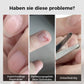 👧  ✨ 3-in-1 Automatischer elektrischer Nagelknipser mit Feilenfunktion【Sicher und bequem】2
