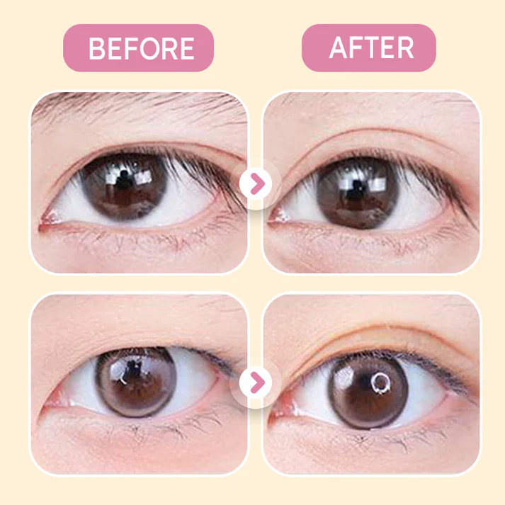 🌸Unsichtbarer leistungsstarker doppelter Augenlidkleber vergrößert beide Augen🌸Limited Time 50% off