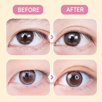 🌸Unsichtbarer leistungsstarker doppelter Augenlidkleber vergrößert beide Augen🌸Limited Time 50% off
