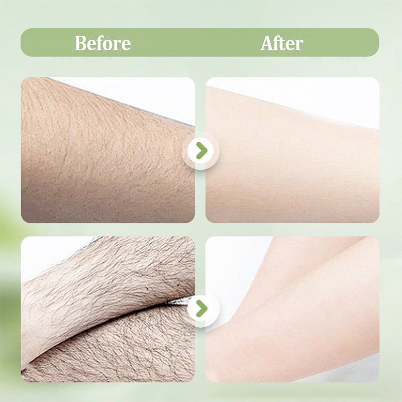 🧴 JETZT 50 % RABATT! 🪒 Mildes und schonendes Set – Haarentfernungscreme + Rasiermesser – Schmerzfrei für empfindliche Haut, keine dunklen Flecken oder Stoppeln 🌸
