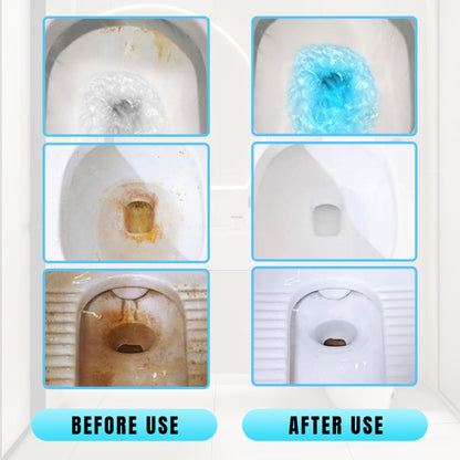 ✨🚽 Effektiver konzentrierter Entkalkungs-Toilettenreinigungsstab 🧼 Je mehr du kaufst, desto mehr sparst du! 🔥