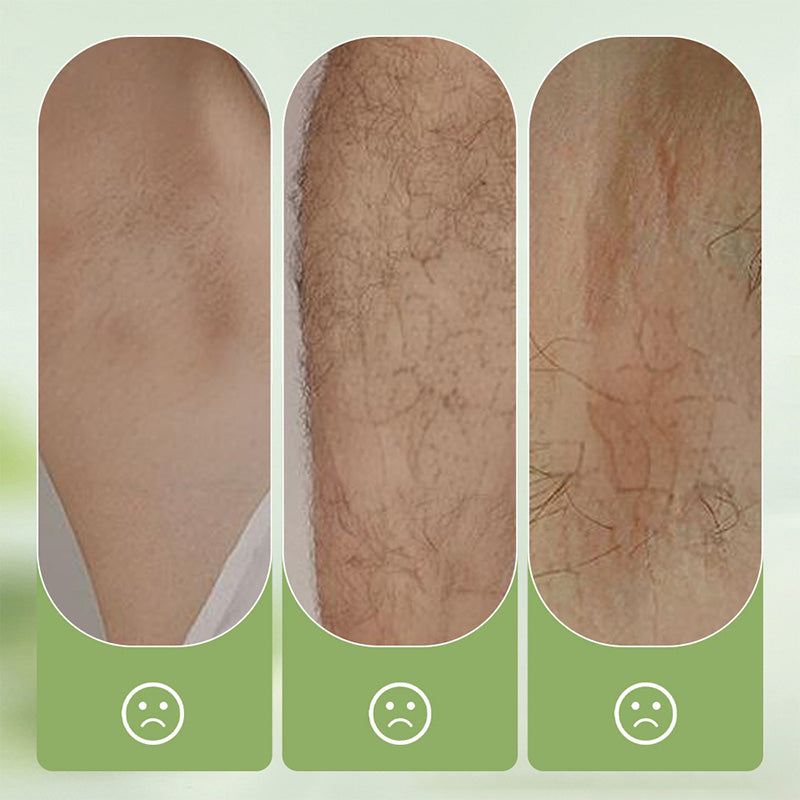 🧴 JETZT 50 % RABATT! 🪒 Mildes und schonendes Set – Haarentfernungscreme + Rasiermesser – Schmerzfrei für empfindliche Haut, keine dunklen Flecken oder Stoppeln 🌸