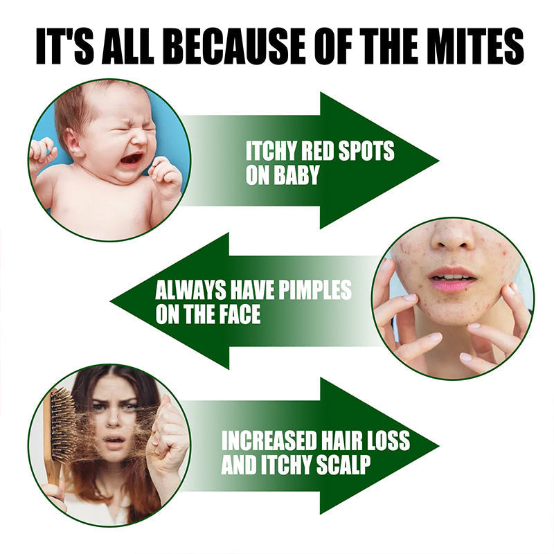 🦠❌Leistungsstarkes Milbenentfernungsspray