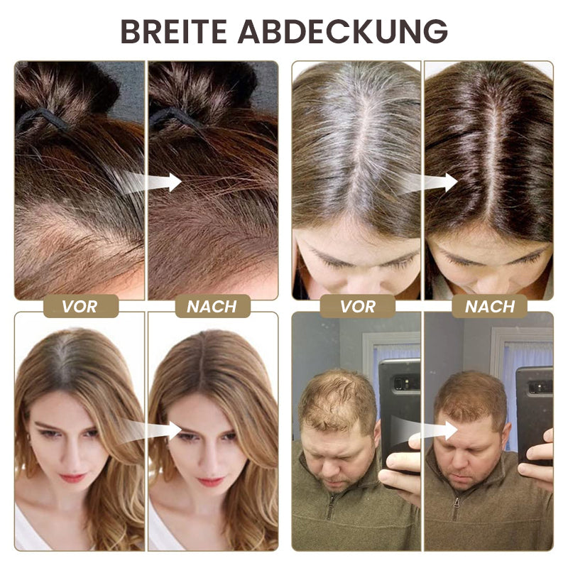 🎁 1 kaufen = 1 GRATIS | 🔔Haaransatzpuder – Kaschiert lichte Stellen sofort