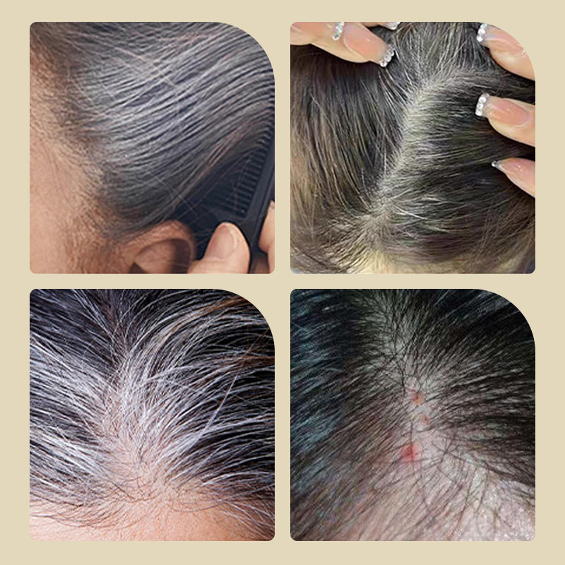 🔥1 KAUFEN, 1 GRATIS🎁Haarfärbemittel mit integriertem Kamm | 🌿 Sichere und sanfte Formel⚡ Schnelle Abdeckung grauer Haare Für zu Hause und unterwegs geeignet