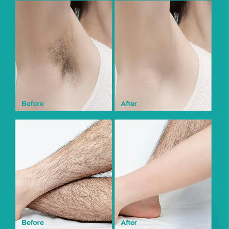 💎 -50% SCHMERZFREIE HAARENTFERNUNG! 💎 Aloe Vera Creme für samtweiche Haut in 8 Min 🌿
