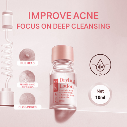 Salicylsäure Flecken-Trocknungs-Lotion – Zielgerichtete Mitesserbehandlung für klarere Haut