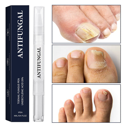 ✨Neuheiten🔥Feder zur Behandlung von Nagelpilz bei beschädigten Nägeln