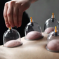 📢📢50 % Rabatt!! ⏰Vakuum-Schröpftherapie-Set – Verdickt, mit Saugpumpe, transparent 🩺