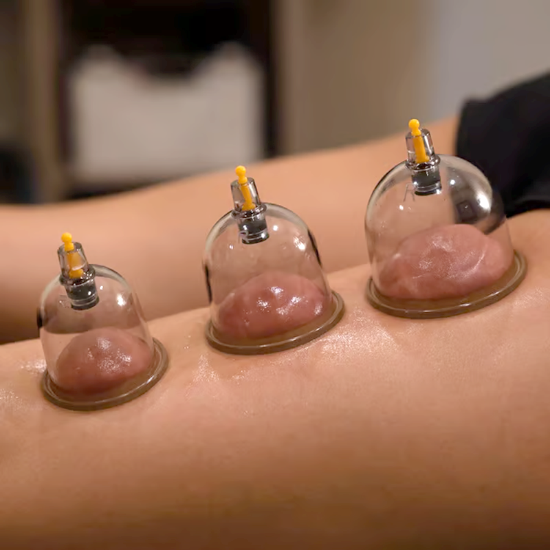 📢📢50 % Rabatt!! ⏰Vakuum-Schröpftherapie-Set – Verdickt, mit Saugpumpe, transparent 🩺